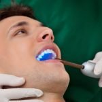 Tooth Bonding Versus Veneers